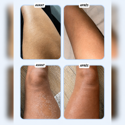 Serviette de Douche Exfoliante Antibactérienne Solmarea